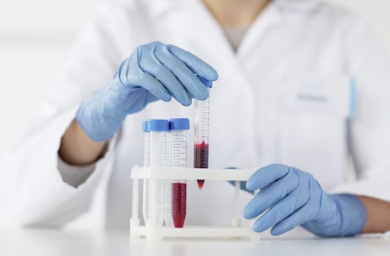 CAR-T加持 半相合移植破局 先进疗法开创血癌新希望