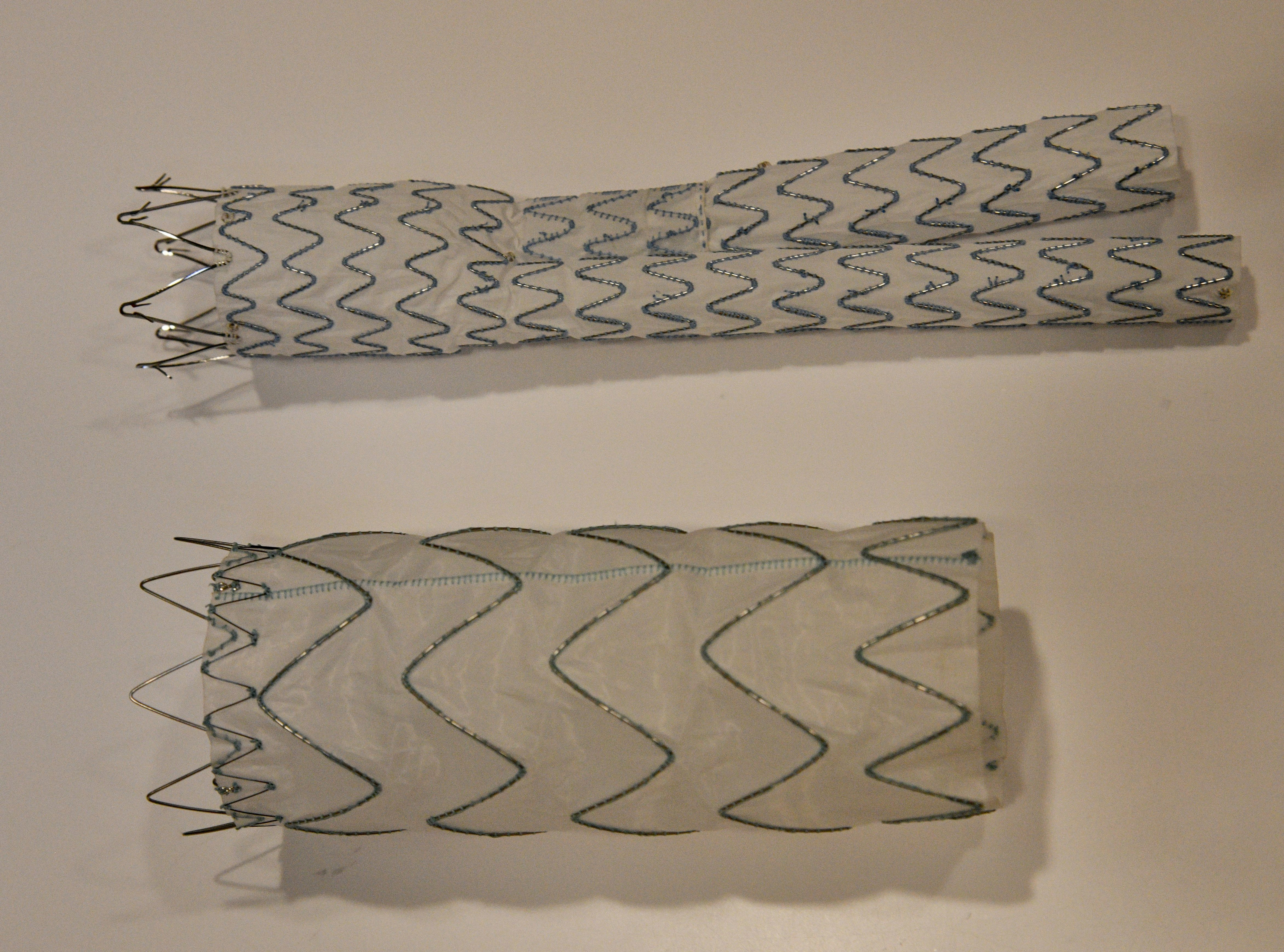 藏在体内的计时炸弹 腹主动脉瘤 一旦破裂死亡风险高