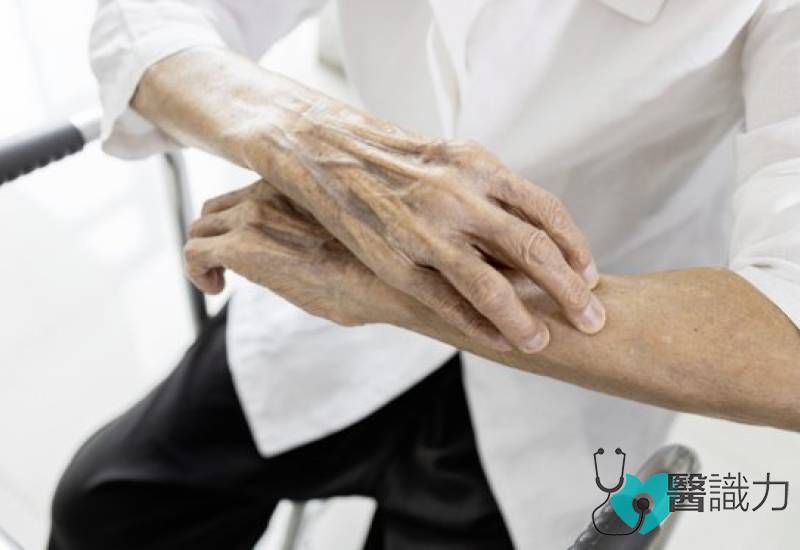 问医-陈伟璋-如何改善皮肤瘙痒-从保养检查到用药全解析