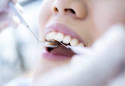 问医-侯锦泉-牙齿矫正不只是为了好看-改善咬合-守护口腔健康